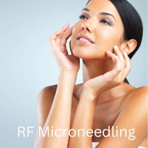 RF-Microneedling-treatment-mn