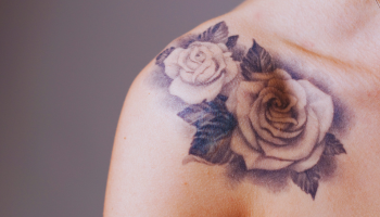 best tattoo removal minneapolis